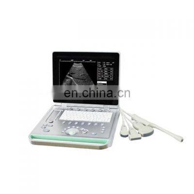 Amazon best selling  ultrasound polyurethane probe covers probe ultrasound ultrasound probe cover