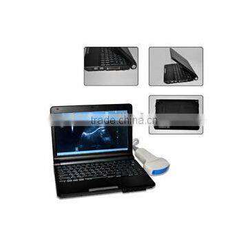 CE Hot Sale Portable Laptop Ultrasound Scanner/Machine Hospital Clinic Diagnosis With Probe/Transducer and Printer photo-2