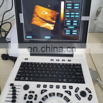 Portable Full Digital 15inch 2D 4D Medical Ultrasound Instruments for Hospital Use photo-3