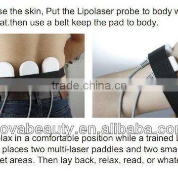 NV-650A Best Fat Slimming Laser Slimming Equipment
