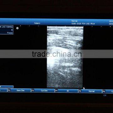 Laptop 3D Ultrasound Machine for Vet Use photo-5