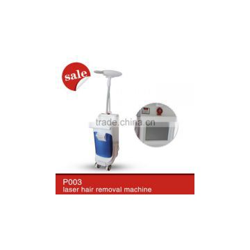 China Professional Depilation Latest technology soft light diode laser hair removal machine price