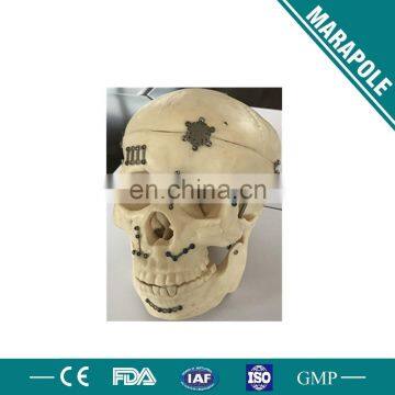 Titanium Cranial Plate, Cranial Screw photo-6