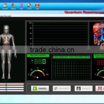 43reports Quantum Magnetic Resonance Analyzer With Many Language photo-5