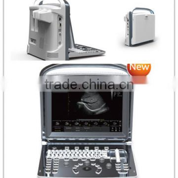 2015 Professional Ultrasound Scanner ECO1 optional Convex linear rectal transvaginal probe foot switch video printer battery