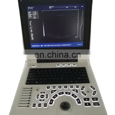 Cost-effective hospital portable notebook B/W  ultrasound with convex probe