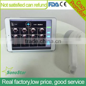 Sonostar new 3D 4D laptop ultrasound scanner ipad ultrasound scanner for sale BProbe-2