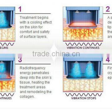 TRF-02 Ther-mage RF Pixel Wrinkle Removal Beauty Machine, Achieving Fractional and Continuous Treatment photo-3
