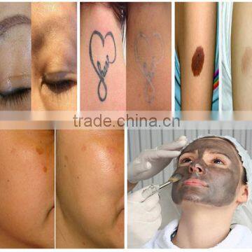 Pigmented Lesions Treatment Merry Christmas! Portable Nd Yag 800mj Tattoo Removal Machine Q Switch Laser For Q1
