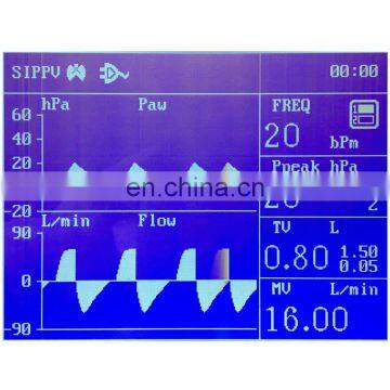 Factory Direct Sale Vet Animal Surgical Equipment Veterinary Anesthesia Machine photo-5