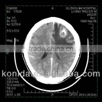 micro media,mobile medical diagnostic x-ray equipment,mri imaging