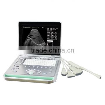 SS-7 Modle Portable Laptop Ultrasound Scanner Machine