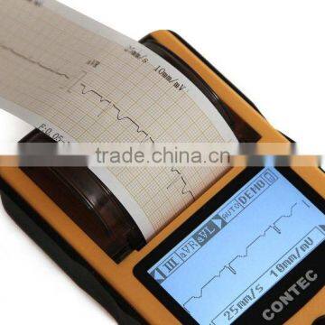 OEM/ODM Supply Digital 1-channel Handheld Electrocardiograph Portable Factory Price of Ecg Machine photo-5
