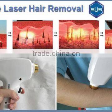 Latest Technology Portable 808 Diode Laser Depilation photo-4