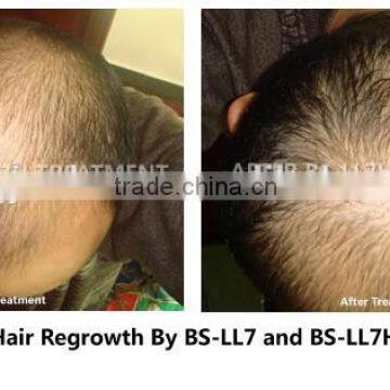 Professional Low Level Laser Therapy Hair Loss Treatment Hair Growth Machine To Men And Women photo-5