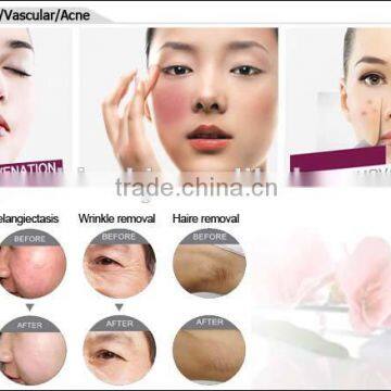 Best Facial Removal Salom Beauty Machine With Beauty Energy Bar photo-6