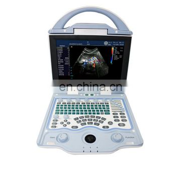 MY-A027A Medical Ultrasound equipment 2D Full digital color doppler system Portable ultrasound machine