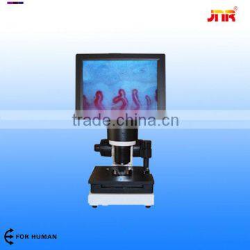 xw880 nailfold video blood capillary health care microcirculation microscope with ce certificate