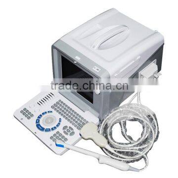 Good Quality Ultrasound Scanner Portable Ultrasonic Diagnostic Machine RUS-6000D With 3.5MHz Convex Probe photo-3