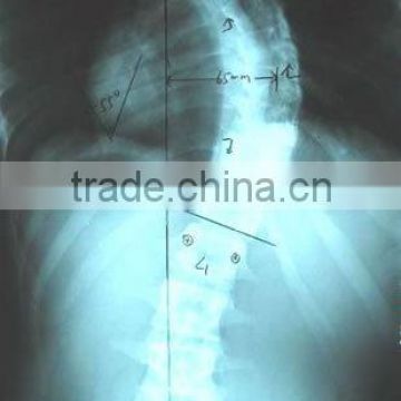 medical x-ray film agfa in made in china com, fuji medical x-ray film