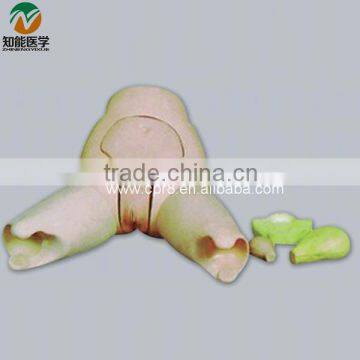 Advanced Uterus Fundus Examination and Evaluation Model BIX-F31