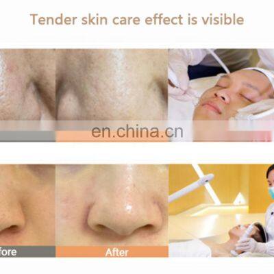 Face Cleaning Machine/Galvanic And Ultrasonic Facial Massager/Dermabrasion Equipment Filter For Diamond Dermabrasion photo-5