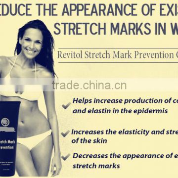 Stretch Mark Removal Cream