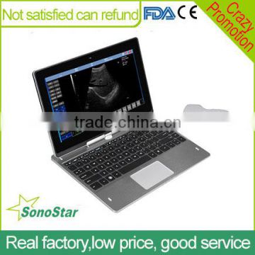 Sonostar Cheap Price of Medical Equipments Color Doppler Ultrasound Machine UBook-8