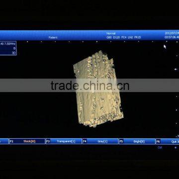 Laptop 3D Ultrasound Machine for Vet Use photo-6