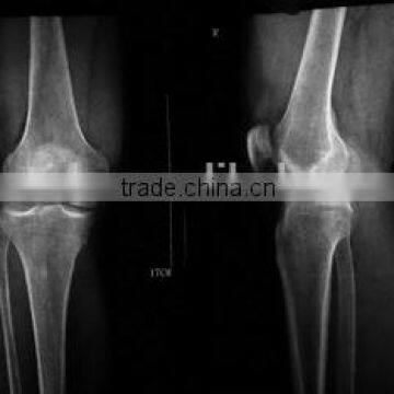 Medical X-ray Film /fuji Printing Clear Image Medical Dry Film With Factory Price photo-6