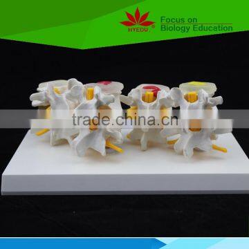 Hot sale hospital school use 2 Vertebral Column model
