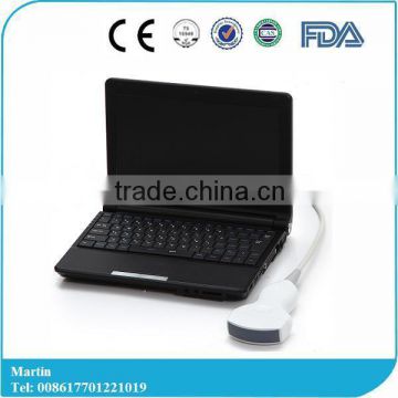 2016 Cheap Price of Large Screen Good Image Laptop Ultrasound Scanner Machine with Convex,Linear, Vaginal Tranducer-RUS-9000F