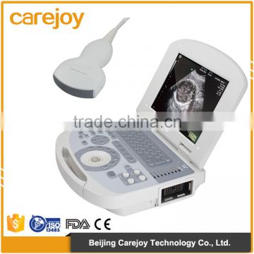 CE ISO approved Obstetrics Gynecoloyg,Urology, Cardiology used portable ultrasound machine china