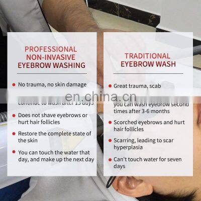 Portable Q-switch Laser Machine ND YAG Tattoo Removal Laser Machine Eyebrow Removal Pigmentation Carbon Peeling Machine photo-3