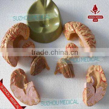 Distribution of Brain and Cerebral Arteries photo-4