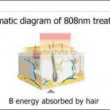 CE Approved Best-selling Diode Laser Gold Standard Hair Removal With 10 BARS photo-5
