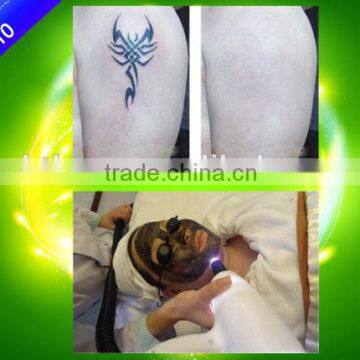 Big Power 500w nd Yag Laser Tattoo Removal Machine With Factory Price