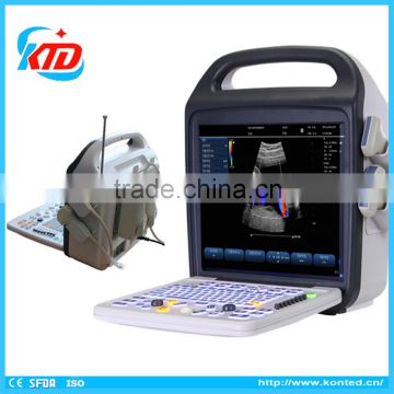 2016 New 3D 4D Color Doppler Ultrasound Machine with CFM, PW, CDE, CCD, HPRF Modes                        
                                                Quality Choice
                                                                    Supplier's Ch