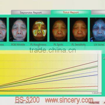 2014 Newest Computer Skin Analyzer Suitable For Windows 8 and Windows 8.1 photo-3