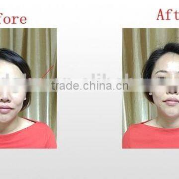 Small Machines to Make Money Face Lifting Machines Thermal rf Beauty Equipment photo-3