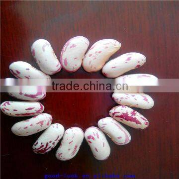 light speckled kidney beans factory price