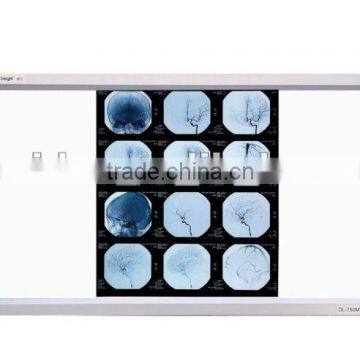 water transfer printing film,konida x ray film,x film,x-ray laser medical films,konida laser film