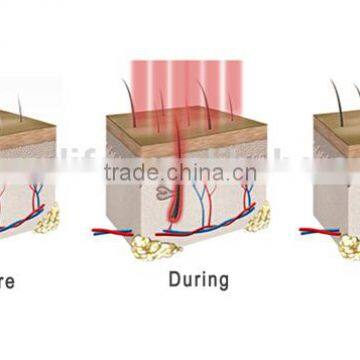 NL-SF650 LOW Price ! Laser Hair Comb Personalized Hair Comb , Laser Hair Regrowth Comb