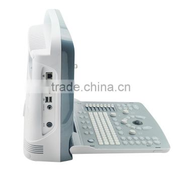 LED rotatable Ultrasound Scanner with 2.5-5.0MHz Convex probe USB VGA Video LAN port CE ISO approved