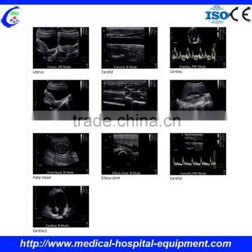 3d/4d Ultrasound Scanner photo-6