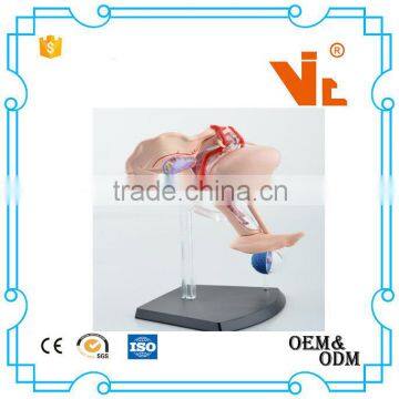 V-HM10 4D MASTER Female Uterus Model photo-3