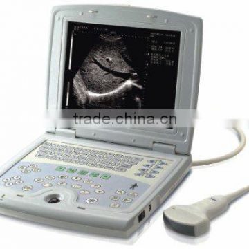 Ultrasound Scanners