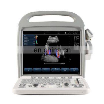 MY-A033 medical appliance 2D color doppler ultrasound scanner veterinary portable livestock ultrasound machine for animal