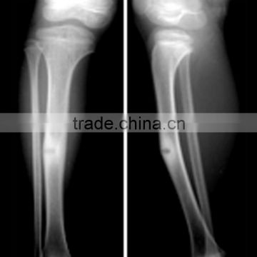 x-ray film price of china factory, film dt2b,fuji medical x-ray film of alibaba supplier