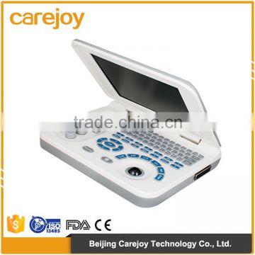 Health & Medical equipment LCD ultrasonic diagnostic ultrasound portable